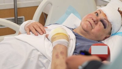 Поранена, Тетяна, удар по Дніпру, 18 травня 2026 року