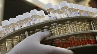 На Буковині понад тисяча людей має підозру на COVID-19
