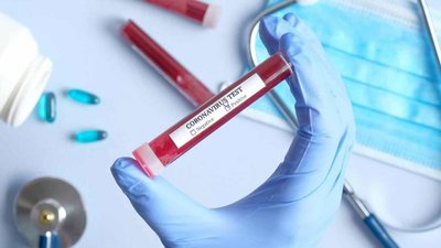 На Чернігівщині за добу коронавірус виявили у 8 людей