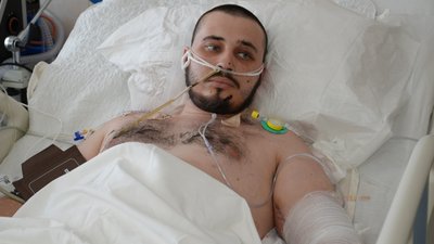 поранений військовий, Ігор