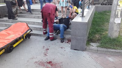 У Чернігові поблизу Макдональдза підрізали чоловіка У Чернігові поблизу Макдональдза підрізали чоловіка