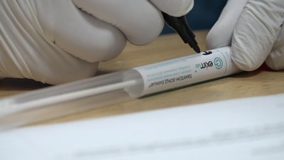 Допуск до роботи: освітяни Житомира здають обов’язковий ПЛР-тест на COVID-19