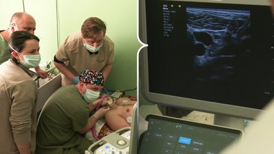Як лікують наслідки ПТСР за новою методикою у госпіталі на Рівненщині