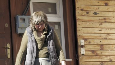 опіки харків опіки харків