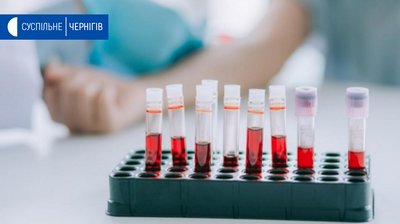 За останню добу на Чернігівщині виявлено 11 випадків COVID-19