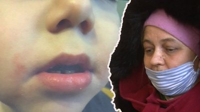 У Луцьку закрили справу щодо виховательки, яку звинувачували у заклеюванні дітям рота скотчем