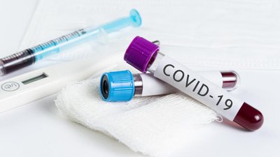 За добу на Херсонщині виявили 171 новий випадок захворювання на COVID-19