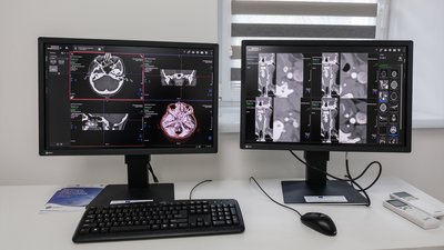 Онкогінекологічні захворювання: на Чернігівщині на обліку понад 5500 пацієнток