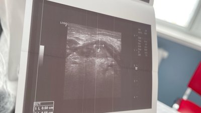 У Львові прооперували 12-річну дівчину, яка мала вроджену патологію У Львові прооперували 12-річну дівчину, яка мала вроджену патологію