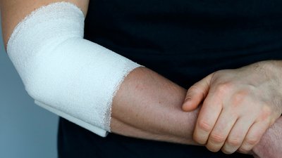 Поранений чоловік: армія РФ атакувала село Костобобрів на Чернігівщині