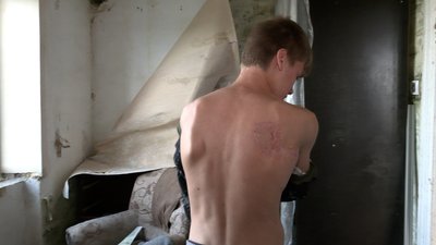 Примусово вивезли пораненого у Білорусь: шлях підлітка з Чернігівщини додому Примусово вивезли пораненого у Білорусь: шлях підлітка з Чернігівщини додому