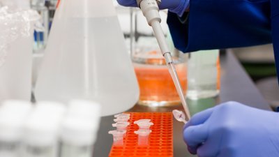 1 469 випадків захворювання на коронавірус виявили за добу на Полтавщині