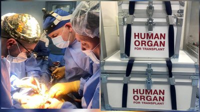 У Вінниці вперше пересадили нирки від померлого донора: як почуваються пацієнти У Вінниці вперше пересадили нирки від померлого донора: як почуваються пацієнти