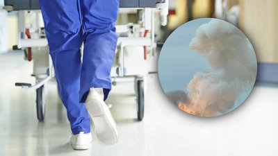 5 поранених внаслідок ракетного удару по Чернігову