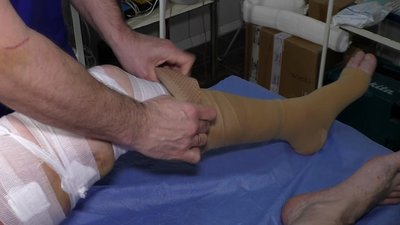 Будні лікарів військового госпіталю Запоріжжя Будні лікарів військового госпіталю Запоріжжя