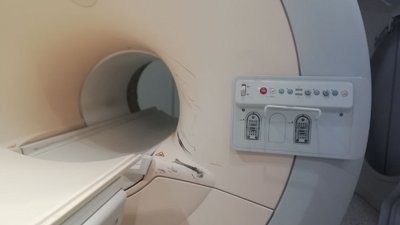 Під час ремонтних робіт в кімнаті МРТ в обласній лікарні у Житомирі пошкодився томограф