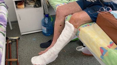 Житель Ізюма підірвався на російській міні під час прогулянки з псом Житель Ізюма підірвався на російській міні під час прогулянки з псом