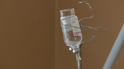 У Кременчуцькому районі підтвердили випадок кору в дорослого: що з пацієнтом