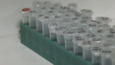 Львівські науковці розробляють препарат, який загоює рани