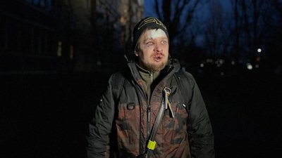 Побитий волонтер у Кам'янському