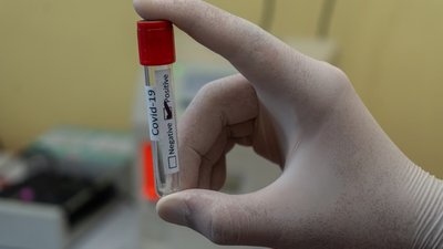 31 випадок захворювання на COVID-19 зафіксували за добу на Полтавщині