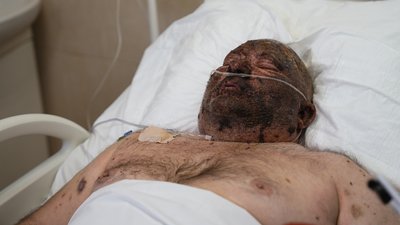 удар по автобусах у Краматорську, поранений через атаку РФ