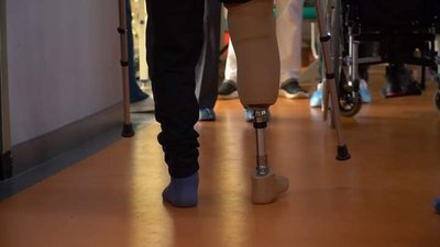 Жителі Миколаївщини можуть подати заяву на отримання безплатних протезів Жителі Миколаївщини можуть подати заяву на отримання безплатних протезів