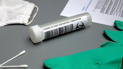 688 випадків захворювання на коронавірус виявили за добу на Полтавщині