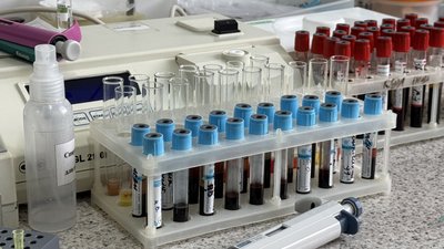 На Сумщині зростає захворюваність на коронавірус
