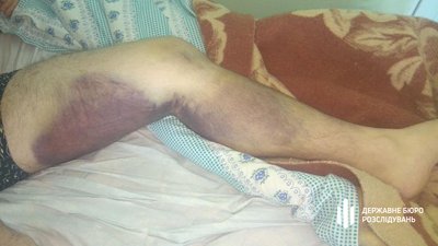 Шестеро миколаївських поліцейських опинилися на лаві підсудних за катування чоловіка Шестеро миколаївських поліцейських опинилися на лаві підсудних за катування чоловіка