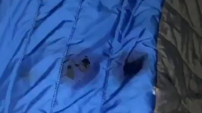 Стрільба у Харкові: до лікарні доставили чоловіка з вогнепальним пораненням Стрільба у Харкові: до лікарні доставили чоловіка з вогнепальним пораненням