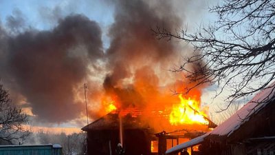 Чоловік зазнав опіків рук під час пожежі будинку на Чернігівщині