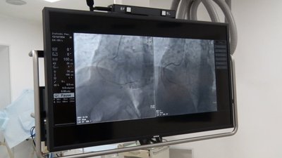 У міській лікарні Житомира встановили новий ангіограф У міській лікарні Житомира встановили новий ангіограф