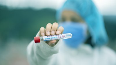 Дніпропетровщина: за добу підтвердили 1822 нові випадки коронавірусу, 7 людей померли