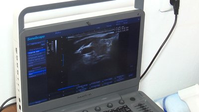 "Емоції вплинули на здоров'я". На Вінниччині обстежили понад 500 переселенок "Емоції вплинули на здоров'я". На Вінниччині обстежили понад 500 переселенок
