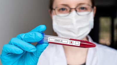 Коронавірус на Чернігівщині: 299 людей захворіли, 612 одужали. 13 людей померли