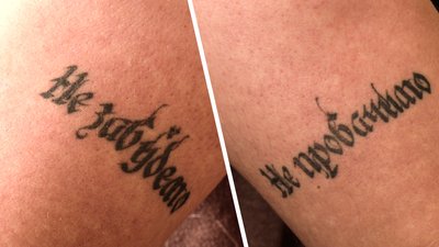 "Хочу бути корисним і в цивільному житті". Історія бійця з ампутацією з Кропивницького