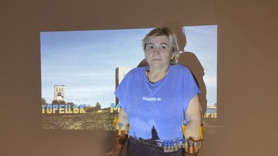 Знову зможе ходити: у Львові протезували жінку з Донеччини Знову зможе ходити: у Львові протезували жінку з Донеччини