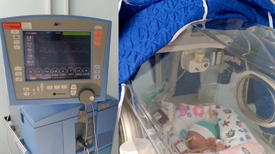 У Житомирський перинатальний центр хочуть купити апарат штучної вентиляції легень