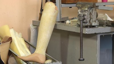 хмельницький протези хмельницький протези
