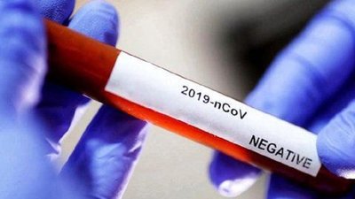 235 жителів Хмельниччини одужали від коронавірусу