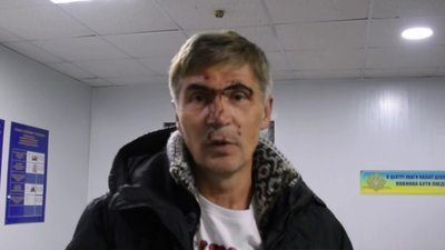 Ексдепутат намагався втекти від миколаївських патрульних