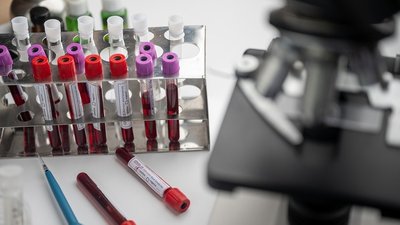 За добу захворювання на COVID-19 підтвердили у 630 мешканців Одещини