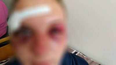 "Нам дуже страшно". Розмова з побитим трансгендером і його матір'ю "Нам дуже страшно". Розмова з побитим трансгендером і його матір'ю
