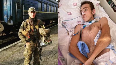 "Мозок почав відмирати": 23-річний військовий перебуває у комі з отруєнням невідомою речовиною
