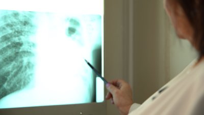 Без вакцини: як на Херсонщині складається ситуація із захворюванням на туберкульоз