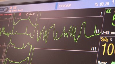 Як зберегти серце здоровим та коли варто звертатися до лікаря. Розмова з кардіологинею