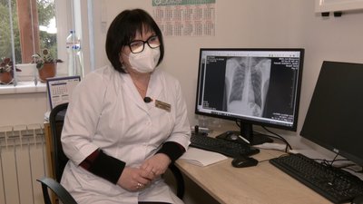 Пересувний флюорограф: у громаді на Волині безплатно обстежують людей