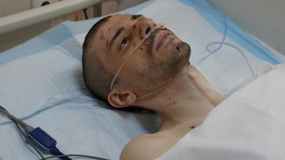 поранений через обстріл Дружківки, мати і брат накрили собою від вибуху, Максим