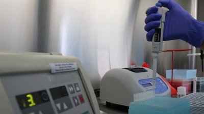 Сумський обласний лабцентр припиняє приймати людей на платне дослідження COVID-19